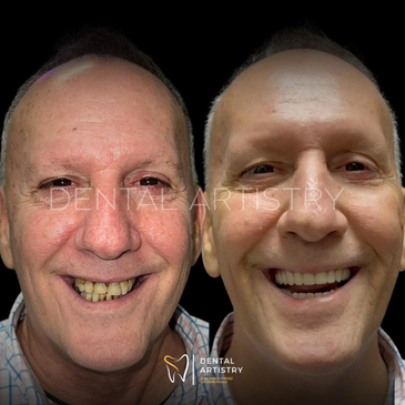 Slider image (9) Dental Artistry Dental Center